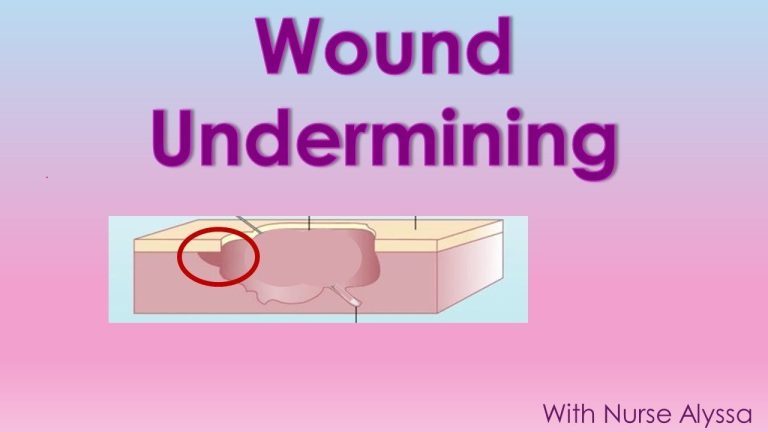 Understanding The Undermining In A Wound | Mansso7